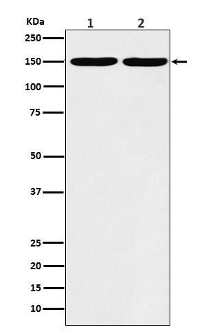 Western blot analysis of Collagen III expression in (1) A431 cell lysate; (2) MCF7 cell lysate