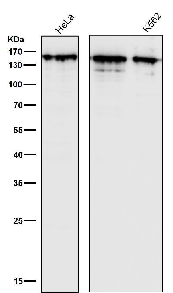 All lanes use the Antibody at 1:1K dilution for 1 hour at room temperature