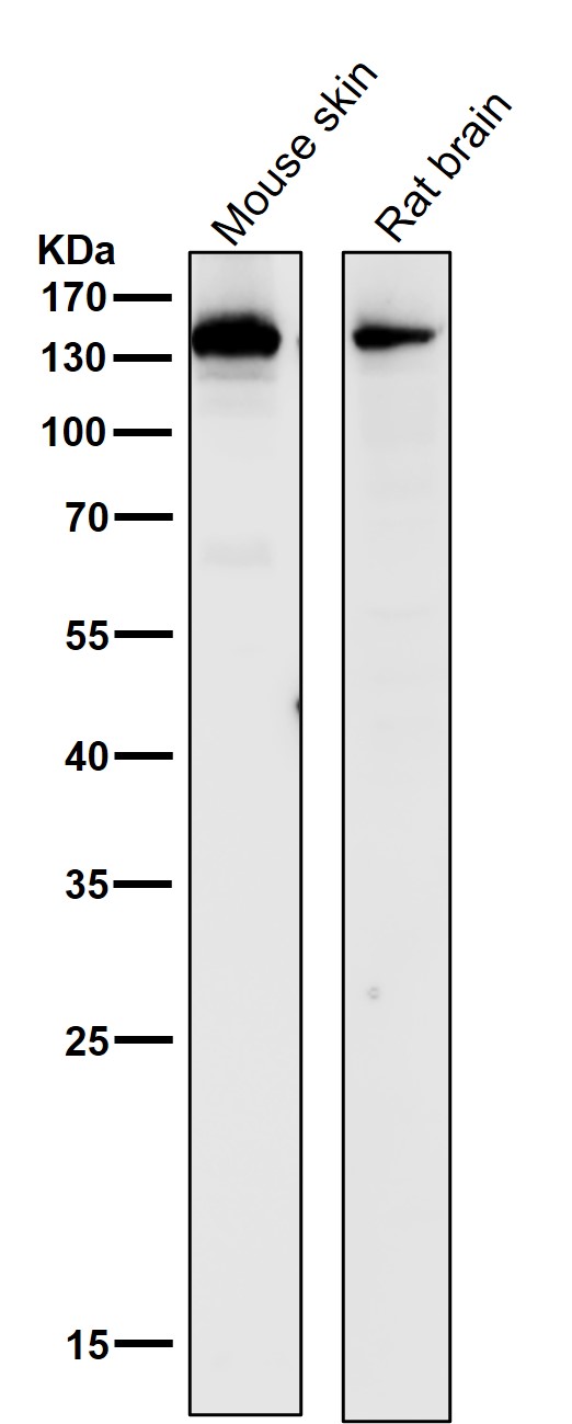 All lanes use the Antibody at 1:1K dilution for 1 hour at room temperature