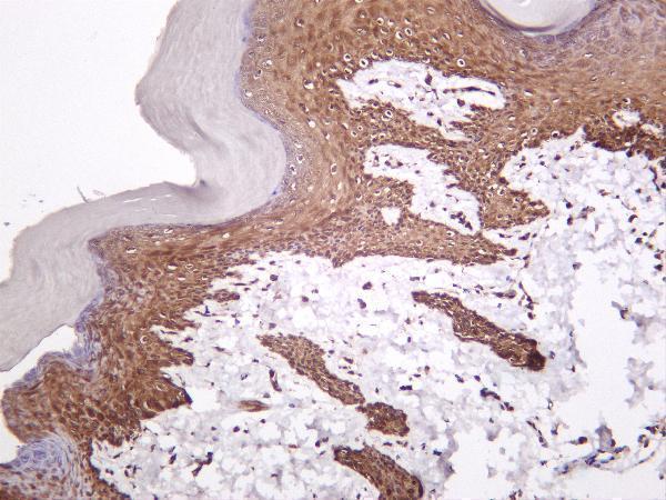 Rat skin was stained with anti-Collagen III rabbit antibody