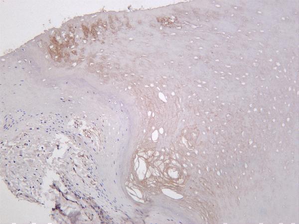 Human skin was stained with anti-Collagen III rabbit antibody