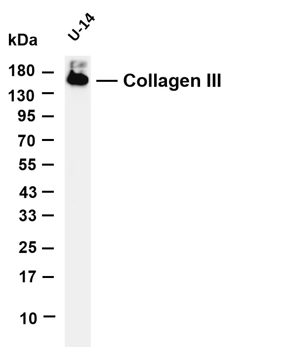 Various whole cell lysates were separated by 4-20% SDS-PAGE, and the membrane was blotted with anti-Collagen III antibody