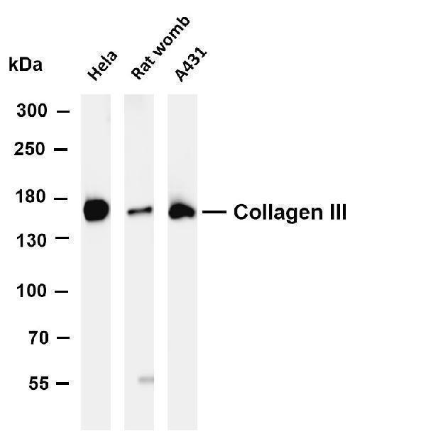 m00788 2 col3a1 primary antibodies wb testing 4