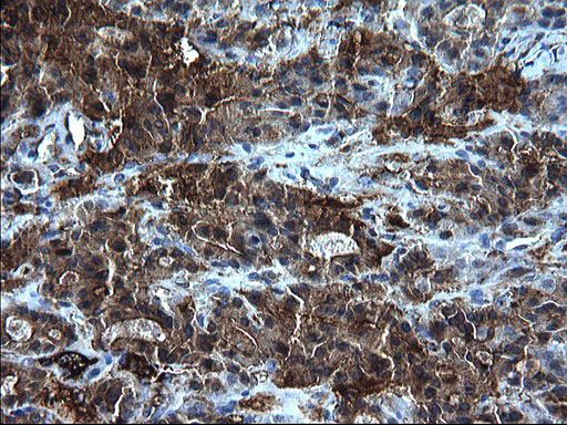 m00790 anti fibrinogen gamma chain fgg mouse monoclonal antibody clone id oti2d2 ihc testing 3
