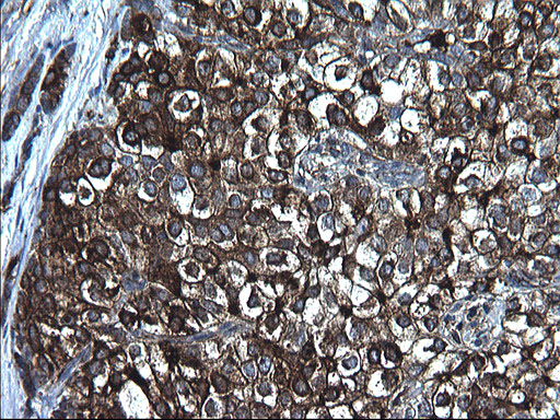 m00790 anti fibrinogen gamma chain fgg mouse monoclonal antibody clone id oti2d2 ihc testing 7