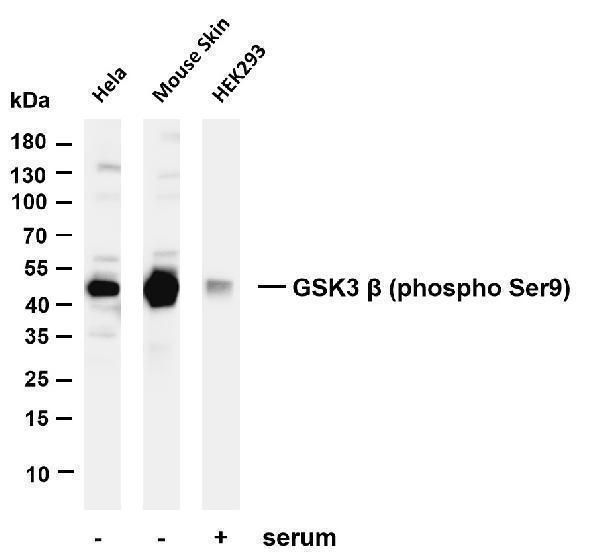Various whole cell lysates were separated by 4-20% SDS-PAGE, and the membrane was blotted with anti-GSK3 β (phospho Ser9) antibody