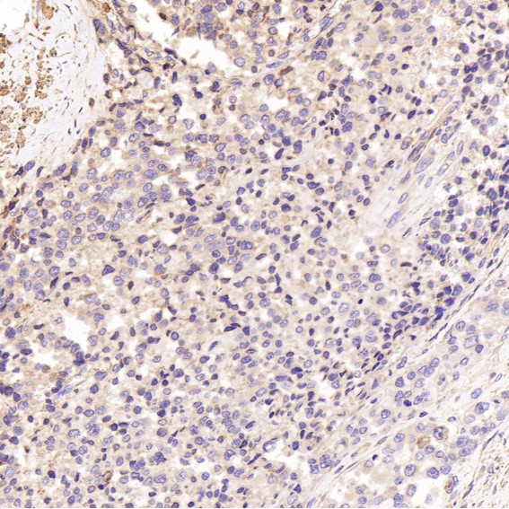 m00791 ihc8
