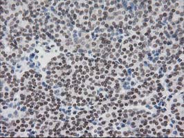 m00792 1 anti cry2 mouse monoclonal antibody clone id oti1h5 ihc testing 4