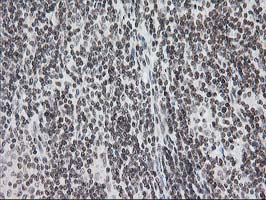 m00792 1 anti cry2 mouse monoclonal antibody clone id oti1h5 ihc testing 6