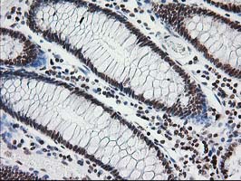 m00792 1 anti cry2 mouse monoclonal antibody clone id oti1h5 ihc testing 8