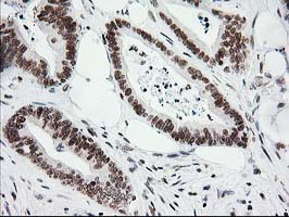 m00792 1 anti cry2 mouse monoclonal antibody clone id oti1h5 ihc testing 9