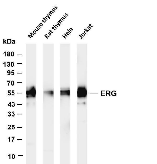 Various whole cell lysates were separated by 4-20% SDS-PAGE, and the membrane was blotted with anti-ERG antibody