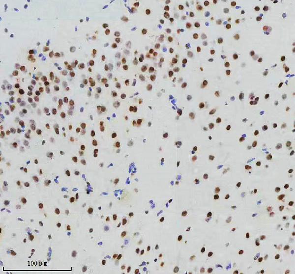 m00794 cdk9 primary antibodies ihc testing 4
