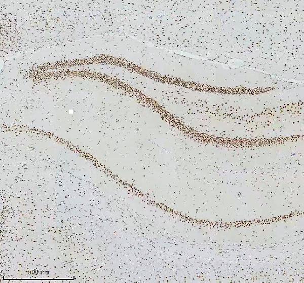 m00794 cdk9 primary antibodies ihc testing 5