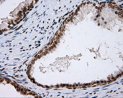 m00796 anti shc shc1 mouse monoclonal antibody clone id oti3a1 ihc testing 2