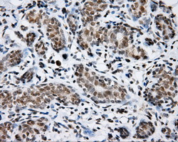 m00796 anti shc shc1 mouse monoclonal antibody clone id oti3a1 ihc testing 3