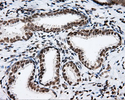 m00796 anti shc shc1 mouse monoclonal antibody clone id oti3a1 ihc testing 4