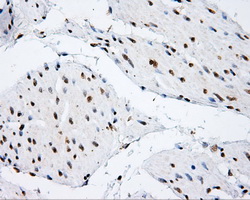 m00796 anti shc shc1 mouse monoclonal antibody clone id oti3a1 ihc testing 5