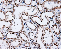 m00796 anti shc shc1 mouse monoclonal antibody clone id oti3a1 ihc testing 7