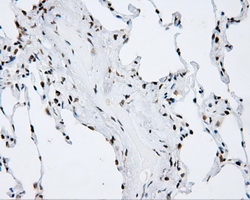 m00796 anti shc shc1 mouse monoclonal antibody clone id oti3a1 ihc testing 9