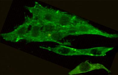 m00799 1 csk primary antiboties icc testing 3