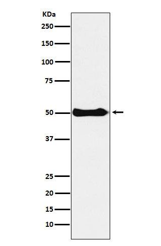 Western blot analysis of CSK expression in Ramos cell lysate