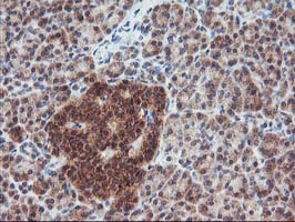 Immunohistochemical staining of paraffin-embedded Human pancreas tissue within the normal limits using anti-FGF21 mouse monoclonal antibody