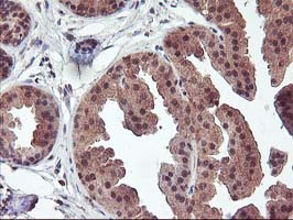 m00802 1 anti fgf21 mouse monoclonal antibody clone id oti2f10 ihc testing 5