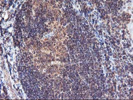 m00802 1 anti fgf21 mouse monoclonal antibody clone id oti2f10 ihc testing 8
