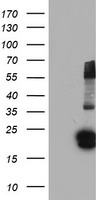 HEK293T cells were transfected with the pCMV6-ENTRY control (Left lane) or pCMV6-ENTRY FGF21 (Right lane) cDNA for 48 hrs and lysed