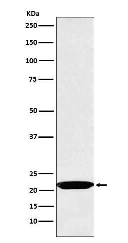 Western blot analysis of Oncostatin M expression in Jurkat cell lysate