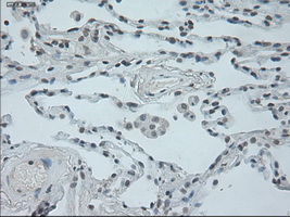 Immunohistochemical staining of paraffin-embedded lung tissue within the normal limits using anti-OSMmouse monoclonal antibody