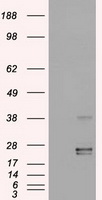 HEK293T cells were transfected with the pCMV6-ENTRY control (Left lane) or pCMV6-ENTRY OSM (Right lane) cDNA for 48 hrs and lysed