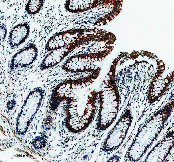 IHC analysis of IRS2 using anti-IRS2 antibody (M00805)