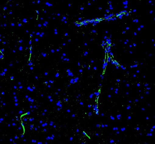 m00806 nestin primary antibodies if testing 1_1