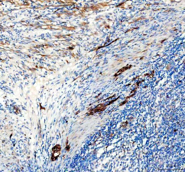 IHC analysis of Nestin using anti-Nestin antibody (M00806)