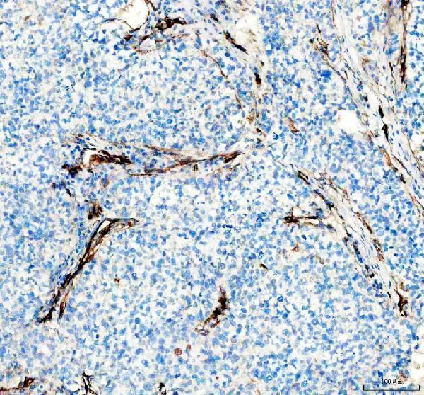 m00806 nestin primary antibodies ihc testing 3
