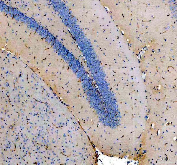 m00806 nestin primary antibodies ihc testing 4