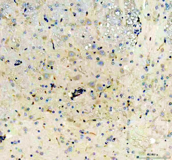 m00806 nestin primary antibodies ihc testing 5