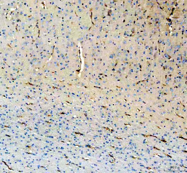 m00806 nestin primary antibodies ihc testing 6