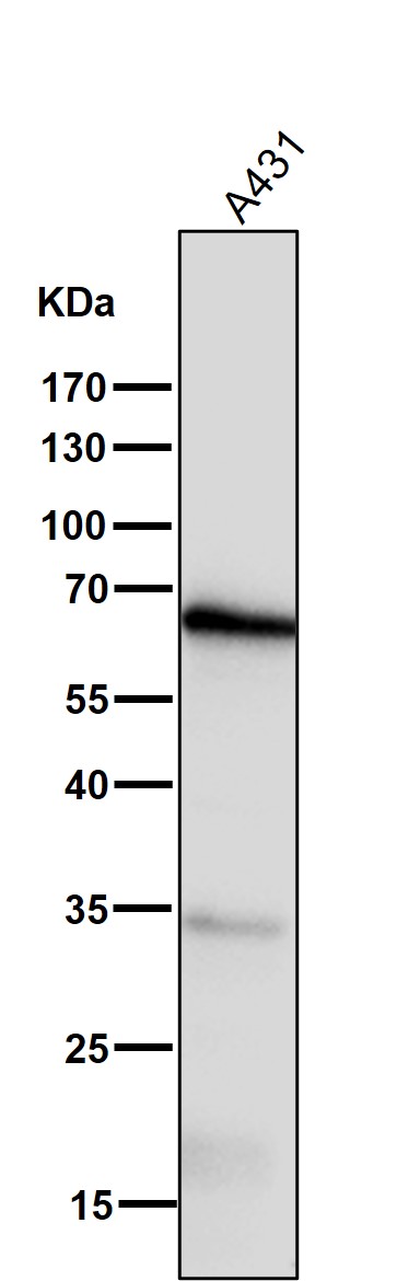 m00811 wb15
