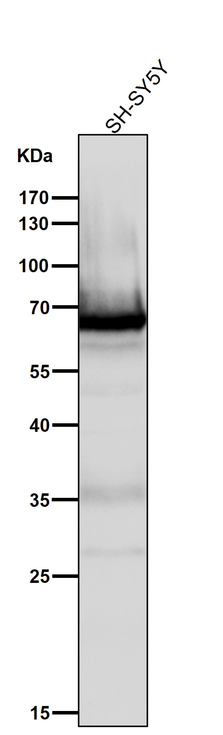 All lanes use the Antibody at 1:3K dilution for 1 hour at room temperature