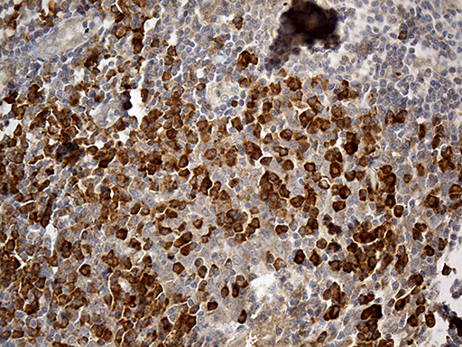 m00812 2 anti cd163 mouse monoclonal antibody clone id oti2b12 ihc testing 4