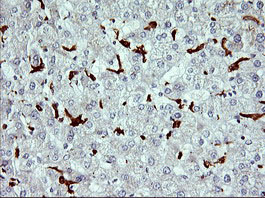 m00812 2 anti cd163 mouse monoclonal antibody clone id oti2b12 ihc testing 5