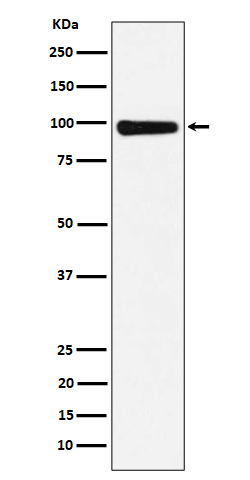 Western blot analysis of CHM expression in 293T cell lysate