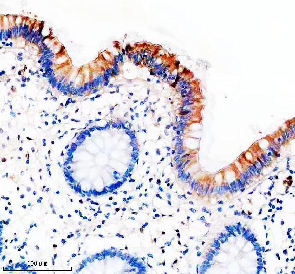 IHC analysis of RIPK2 using anti-RIPK2 antibody (M00818)