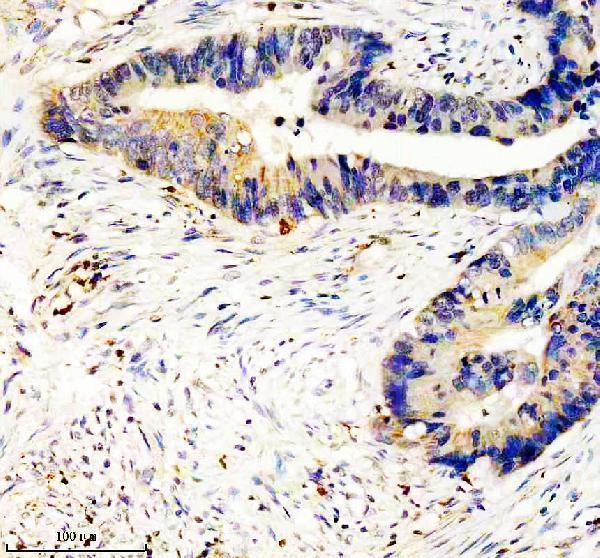 IHC analysis of RIPK2 using anti-RIPK2 antibody (M00818)