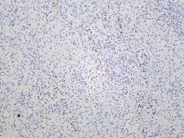 Human spleen was stained with anti-PKC δ rabbit antibody