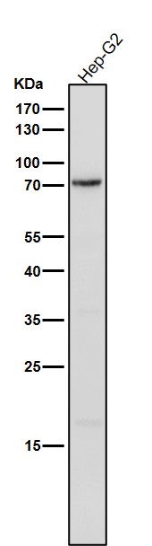 All lanes use the Antibody at 1:1K dilution for 1 hour at room temperature