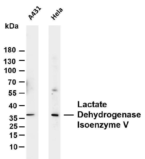 Various whole cell lysates were separated by 4-20% SDS-PAGE, and the membrane was blotted with anti-Lactate Dehydrogenase Isoenzyme V antibody